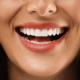 Gros plan d’un sourire éclatant avec des dents blanches et alignées