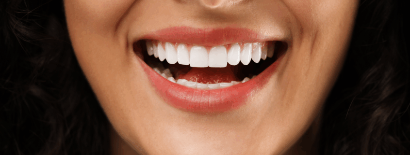 Gros plan d’un sourire éclatant avec des dents blanches et alignées