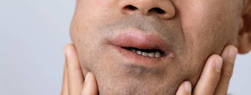 un homme qui souffre d'une douleur aux dents