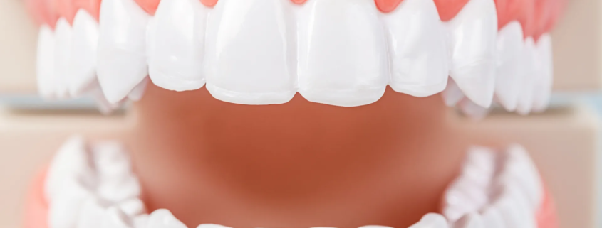 Modèle dentaire montrant des dents blanches et alignées, utilisé pour expliquer l’anatomie bucco-dentaire.