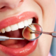 femme qui a la bouche ouverte chez le dentiste