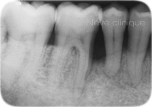 Periodontics - Geneva