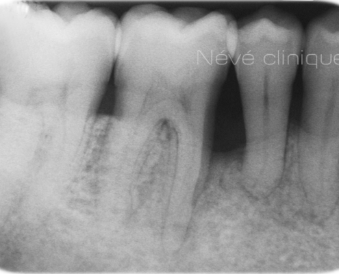 Periodontics - Geneva