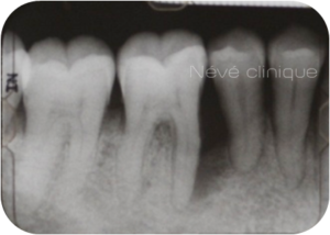 Parodontologie - Genève