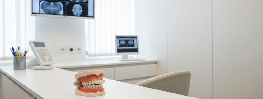Modèle de mâchoires en consultation évoquant la chirurgie orthognathique à Genève