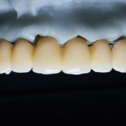 Machoire et dents d'humain