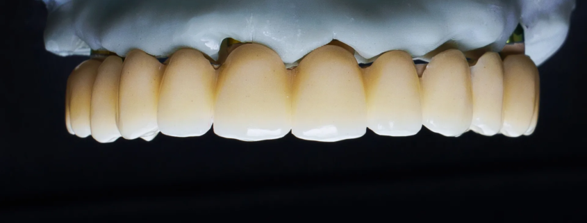 Machoire et dents d'humain
