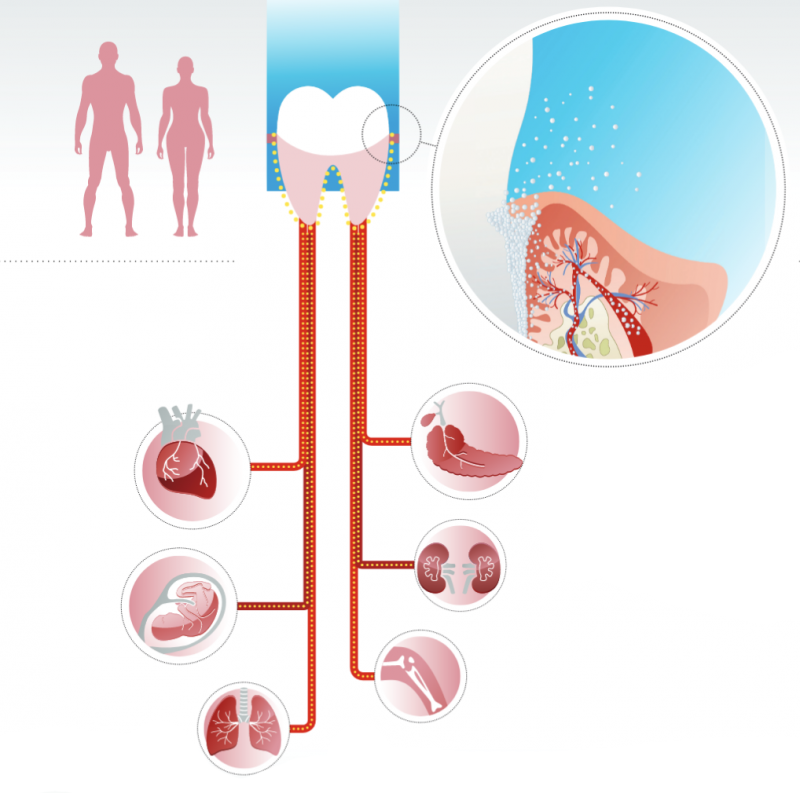 Periodontics - Geneva